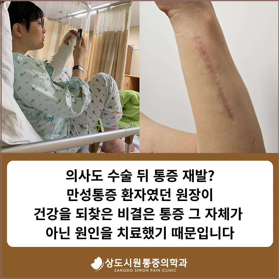 만성통증 환자였던 원장이 수술 후 팔 흉터를 보여주는 사진