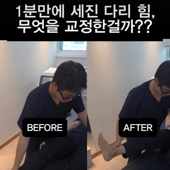 장요근 교정 전후 다리 힘을 비교해 보여주는 인스타그램 영상