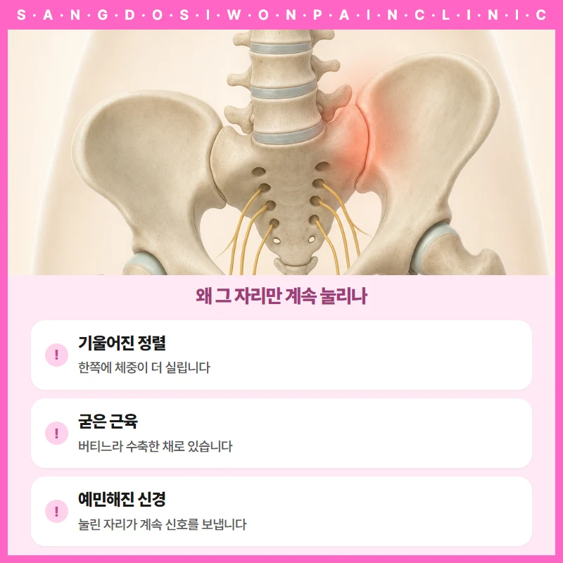 골반과 엉치뼈 해부 그림. 한쪽 천장관절이 붉게 표시되고 엉치뼈에서 나오는 신경 가닥이 보인다. 아래에 왜 그 자리만 계속 눌리는지 세 가지가 적혀 있다. 기울어진 정렬로 한쪽에 체중이 더 실리고, 굳은 근육이 버티느라 수축한 채로 있으며, 예민해진 신경이 눌린 자리에서 계속 신호를 보낸다