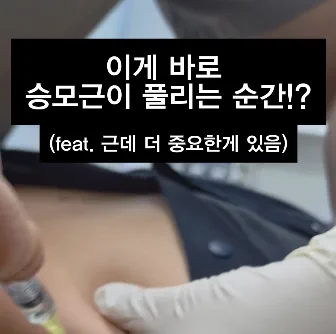 김성훈 원장이 승모근에 주사를 놓는 장면의 인스타그램 영상