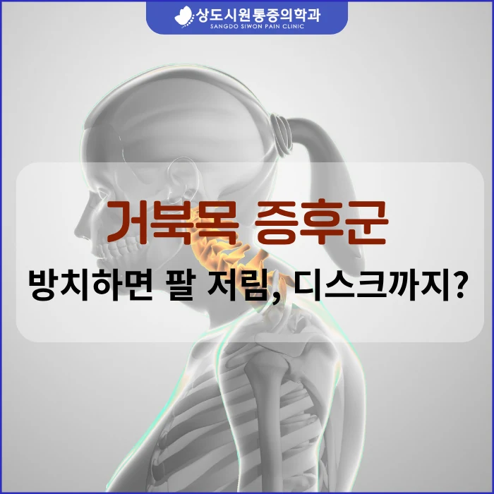 거북목 증후군 방치 시 위험성을 알리는 블로그 썸네일