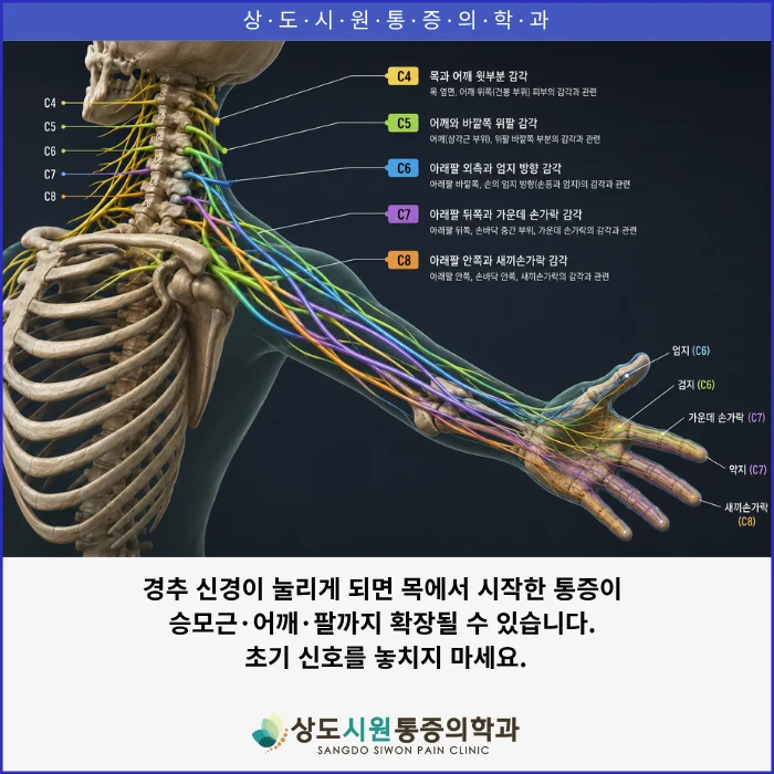 경추에서 나온 신경근이 어깨·팔·손가락으로 뻗어 나가는 경로를 보여주는 도해. 목뼈 사이에서 신경이 눌리면 그 신경이 지나는 팔과 손끝에 저림이 나타난다