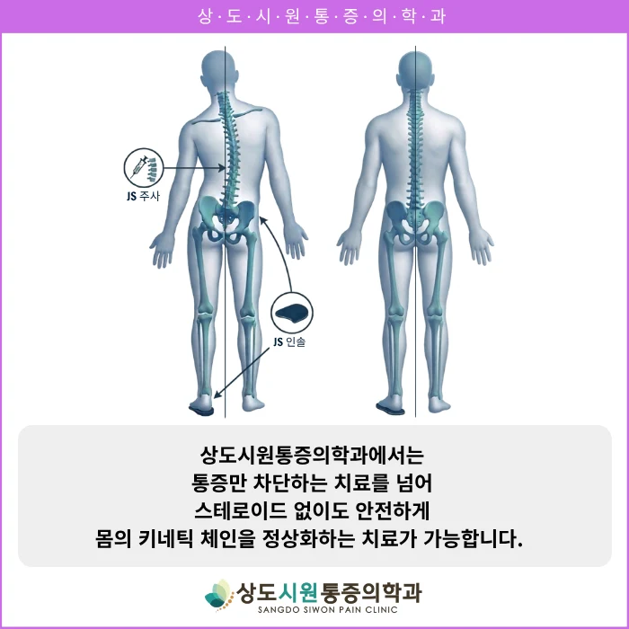 골반이 기울면 좌우 다리 길이에 차이가 나고, 기울어진 골반 위에서 척추가 무게중심을 맞추려 S자로 휘어지는 과정을 보여주는 도해